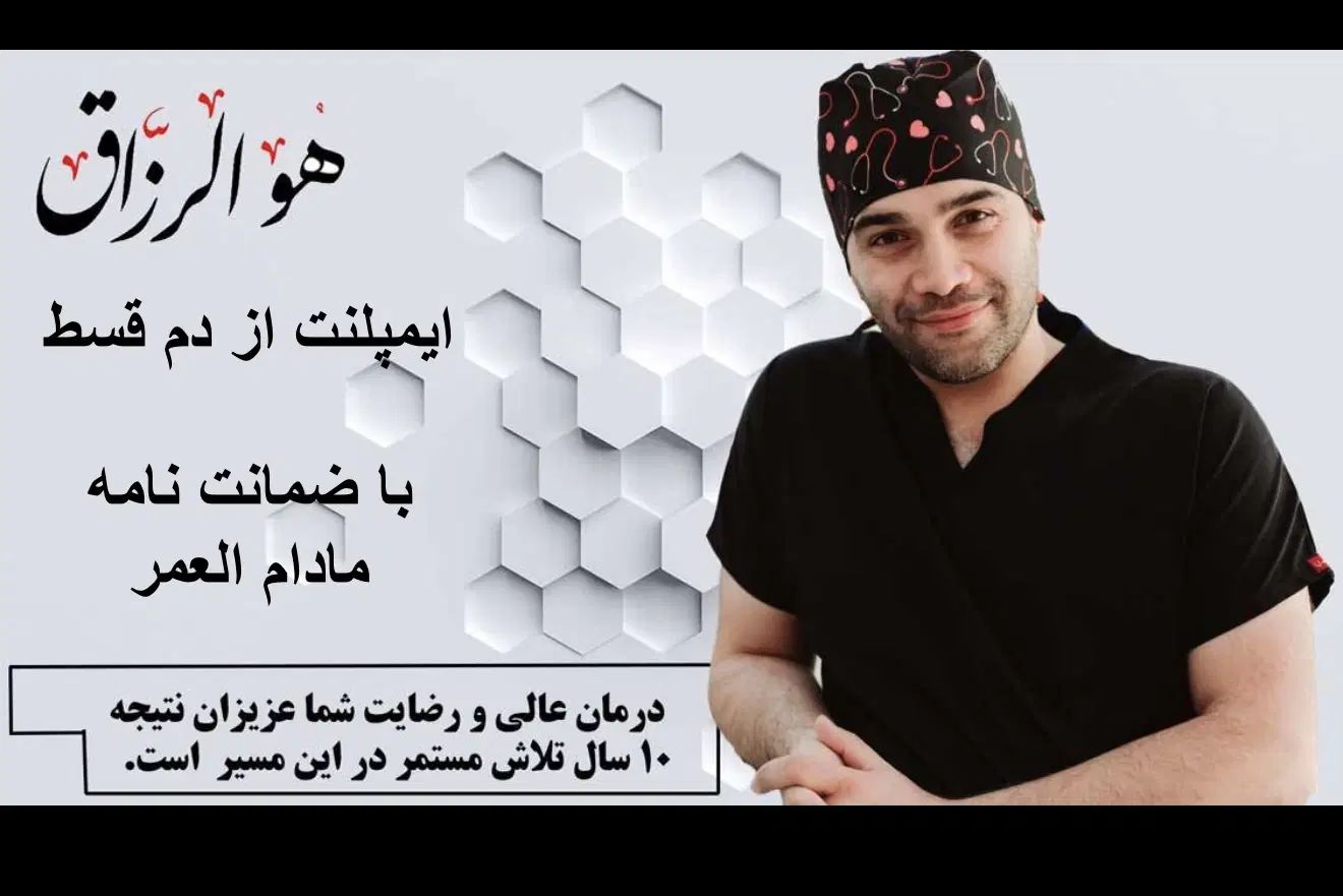ایمپلنت اقساط با ضمانتنامه مادام العمر