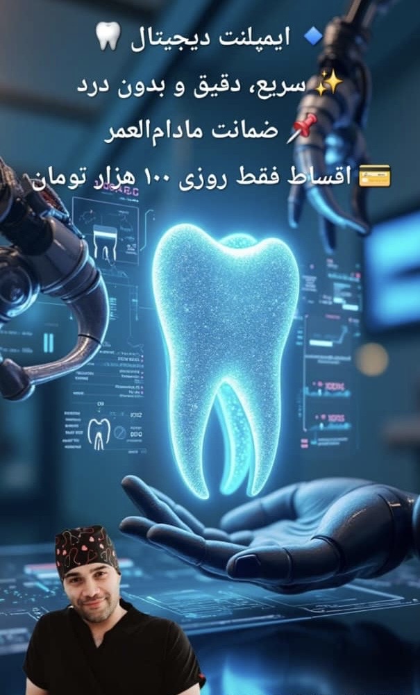 ایمپلنت از دم قسط