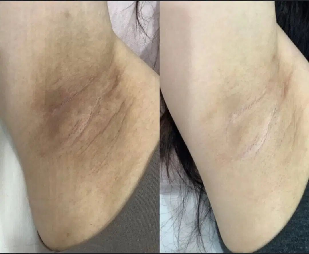 روشن کنندگی نواحی تیره